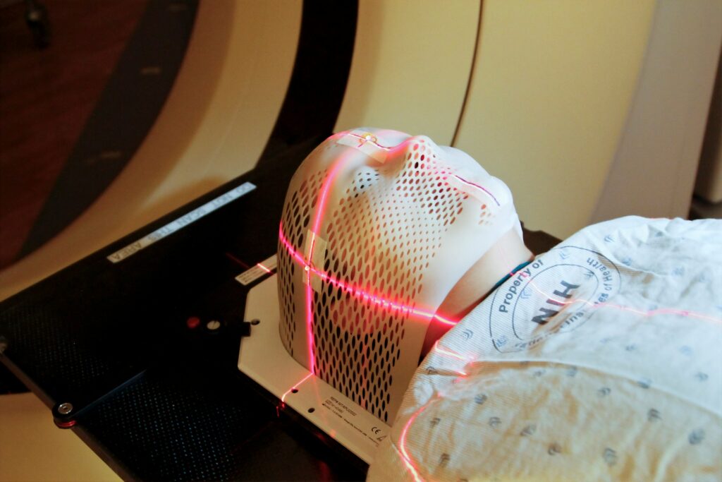 pigmentlaser